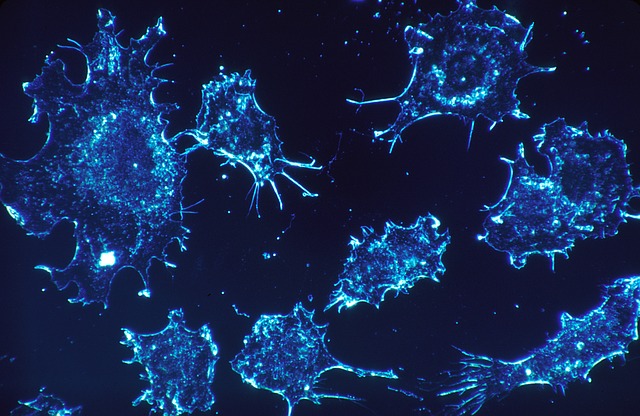 Células cancerosas Células cancerosas