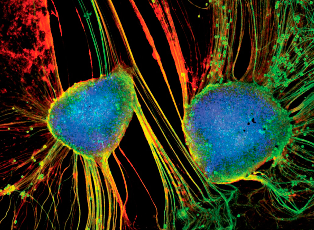 Flexible CNT networks can provide a scaffold that promotes neuronal growth