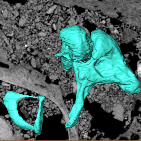 Reconstrucción virtual de un huesecillo del oído 